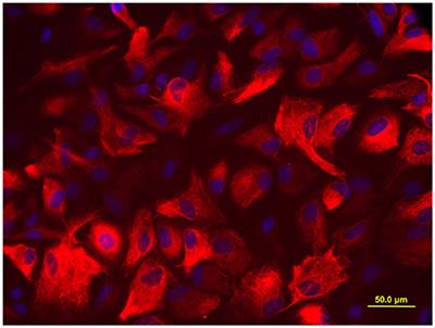 2-Chloroethanol Induced Upregulation of Matrix Metalloproteinase-2 in Primary Cultured Rat Astrocytes Via MAPK Signal Pathways